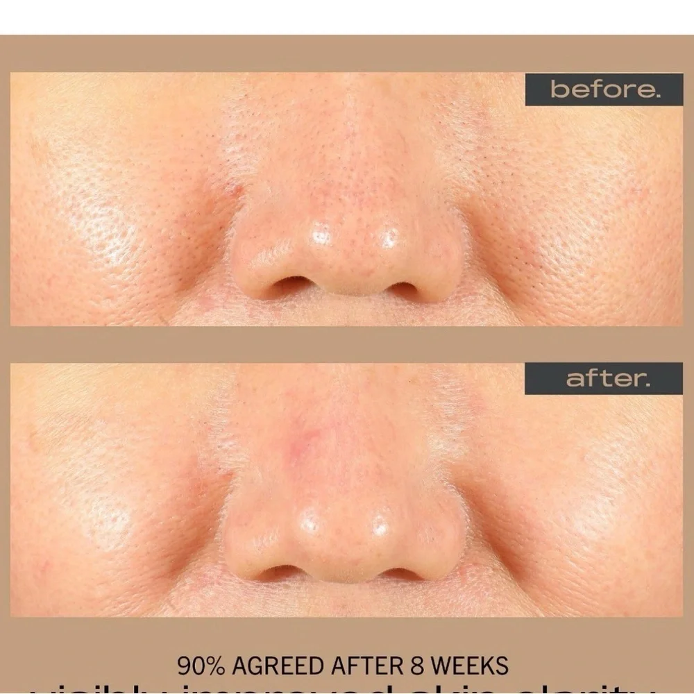 Matter of Fact Resurfacing Serum